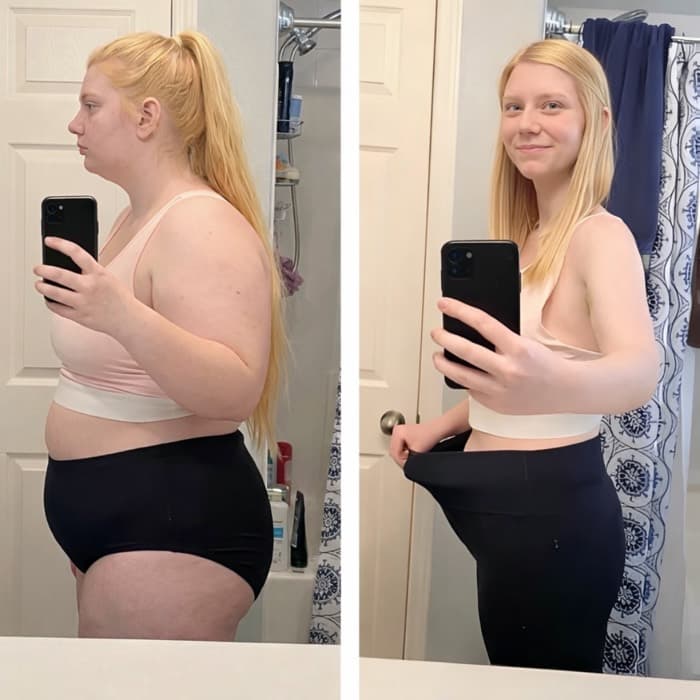 Emily S. before and after transformation